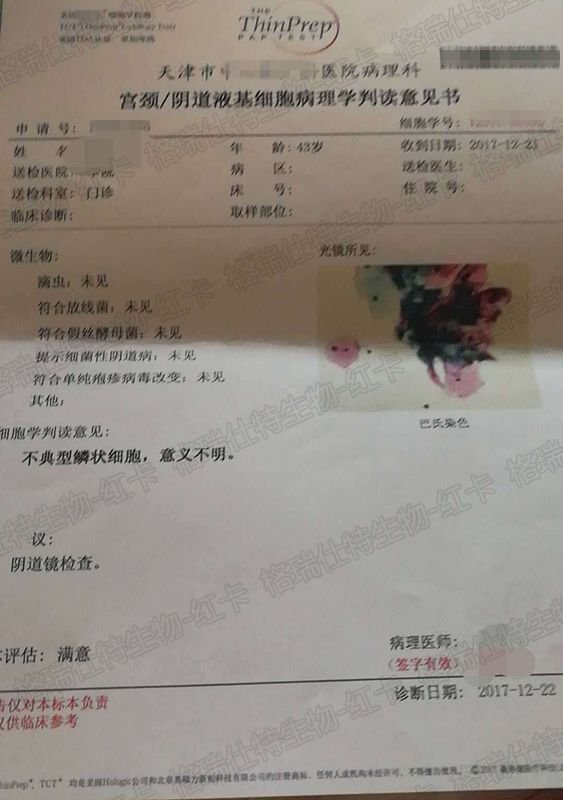 使用红卡后hpv59阳性转阴,同时tct检查结果显示细胞学